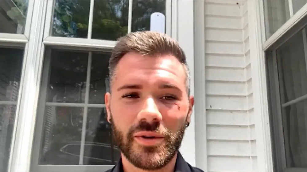 Watch: Brutal P-Town Attack Investigated as Possible Hate Crime; City Beefs Up Police Presence for a Safe and Welcoming July 4th